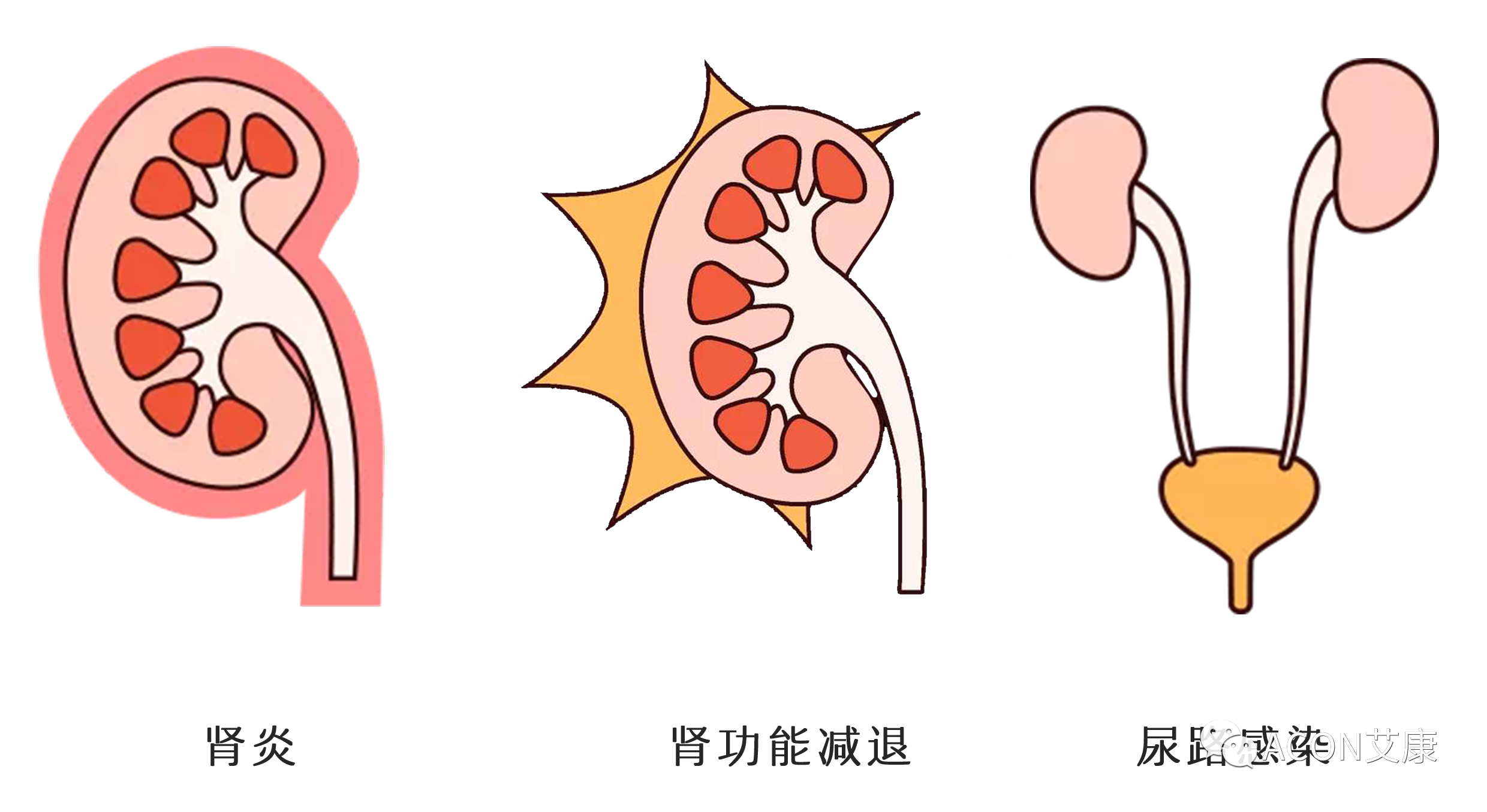 排尿黃、異味大，可能是身體在報警！