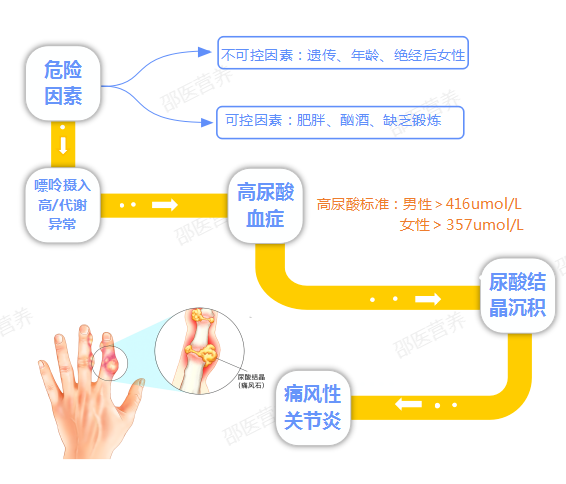 痛風(fēng)為什么偏愛男性？你最關(guān)心的問(wèn)題都在這里