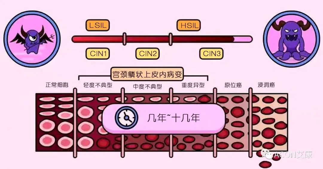 全球首次承諾消除一種癌癥，預計到2050年將挽救500萬人的生命