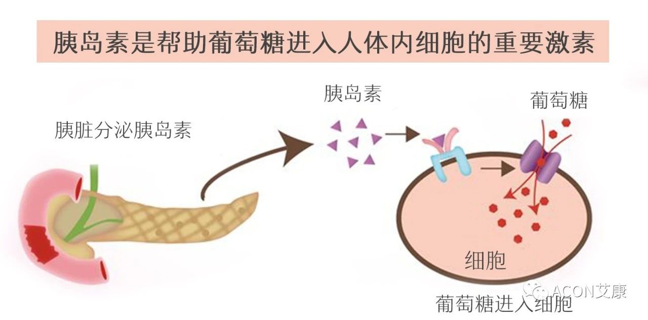爆上熱搜，因爆發(fā)型糖尿病進(jìn)入ICU，有哪些教訓(xùn)值得我們汲取